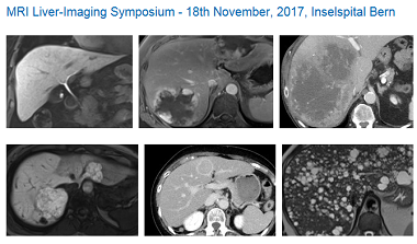 18. November 2017: MRI Symposium
