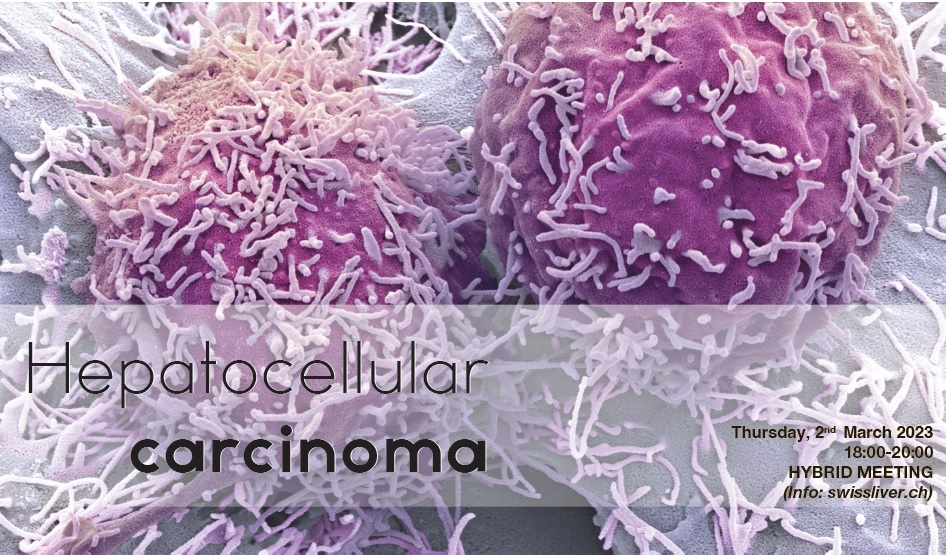 2nd March 2023: 1st Symposium Hepatocellular carcinoma